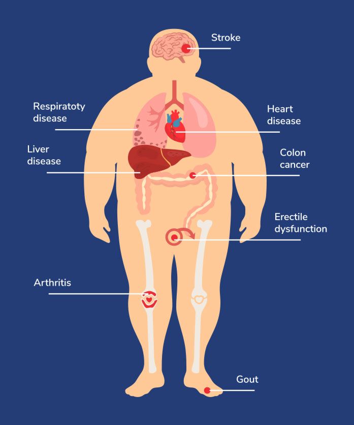 Diagram of obesity and its effects